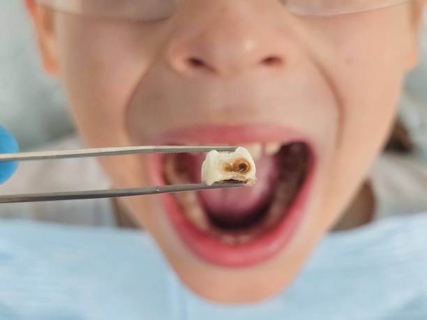 Best Urgent Dental Care  in Colchester, IL